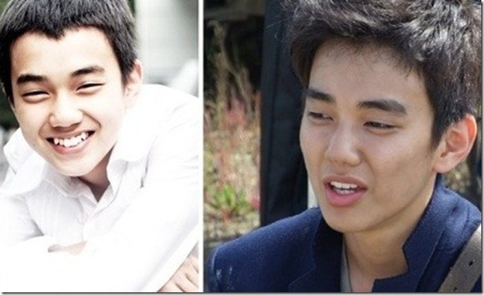 15 корейских знаменитостей, которые в прошлом не могли похвастаться красивой улыбкой